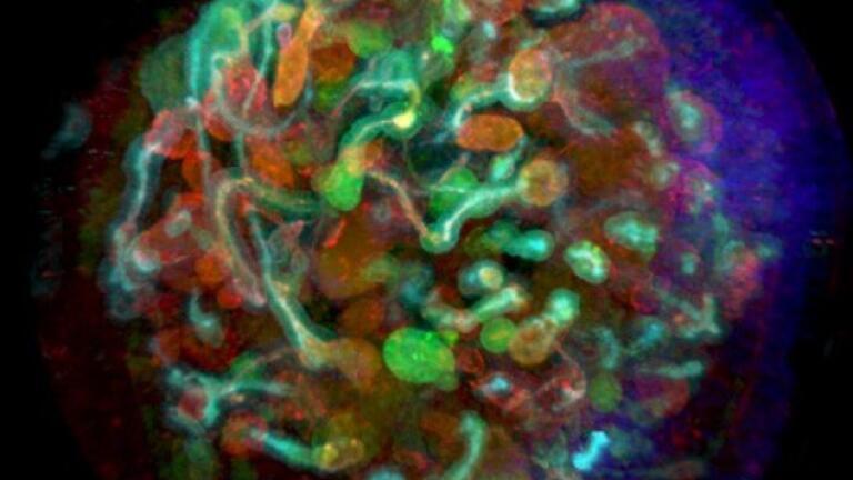 Advanced Technology for Creating Vascularised Kidney Organoids
