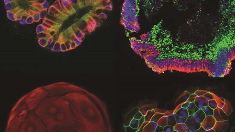Advanced tools for organoid growth, harvesting and storage.