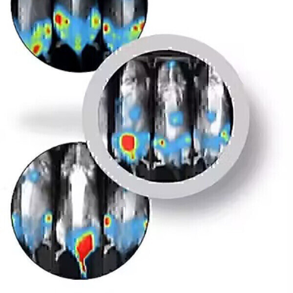 Utilising CDX Mouse Models for Preclinical Studies in AML Research ...