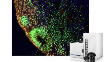 Optical Sectioning Device for High-Contrast and Blur-Free Imaging