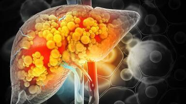 Transforming Clinical Trials with iPSC-Derived Liver Organoids
