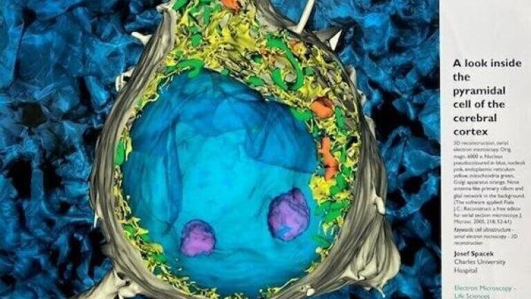 Joseph Spacek - A look inside the pyramidal cell of the cerebral cortex