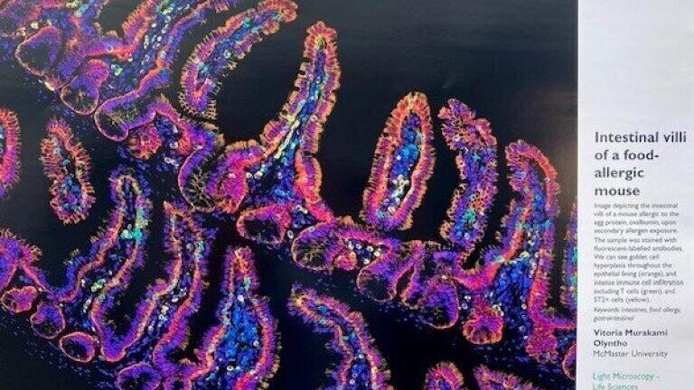 Vitoria Murakami Olymthos  - Intestinal villi of a food-allergic mouse
