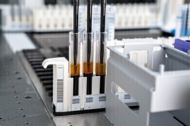 Automation Innovations in Liquid Biopsy and Biobanking