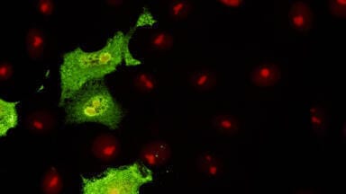 Monoclonal Antibodies to Avian Influenza Viruses