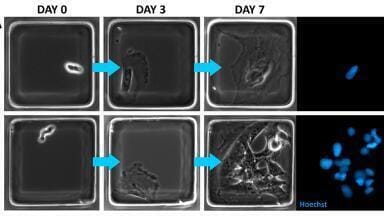 Optimising Cryopreservation for Cardiovascular Research
