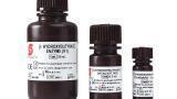 Quantitative Ketone Test for Clinical Ketosis Detection