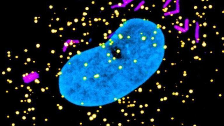 Microscope image of a human macrophage cell that is infected with tuberculosis bacteria (magenta), with the peroxisomes (yellow) and nucleus of the cell labelled (blue).