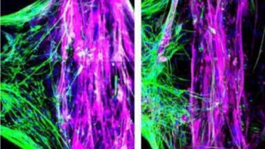 Revolutionising neuromuscular disease research through 3D modelling