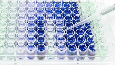 Economical and adaptable ELISA assay kits