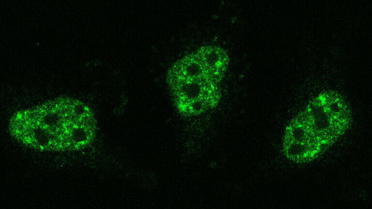 The protein TDP-43 (green) forms small clusters with an important regulatory function in the cell nucleus   (Credit: Yelyzaveta Zadorozhna)