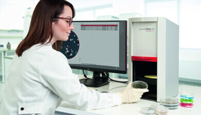 Revolutionise bacterial counting with schuett colonyQuant software
