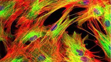 Novel reagents drive breakthroughs in Parkinson's and sleep disorder research