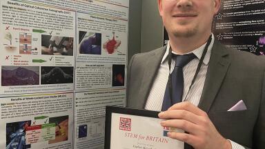 Silver UK STEM award for skin cancer device