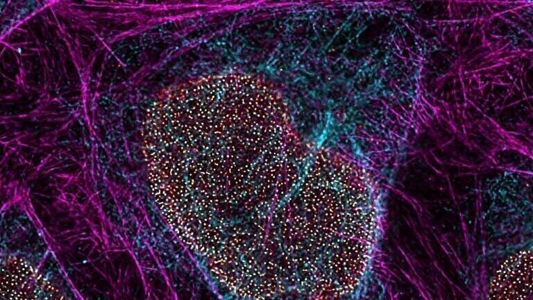 Live cell imaging at nanoscale resolution