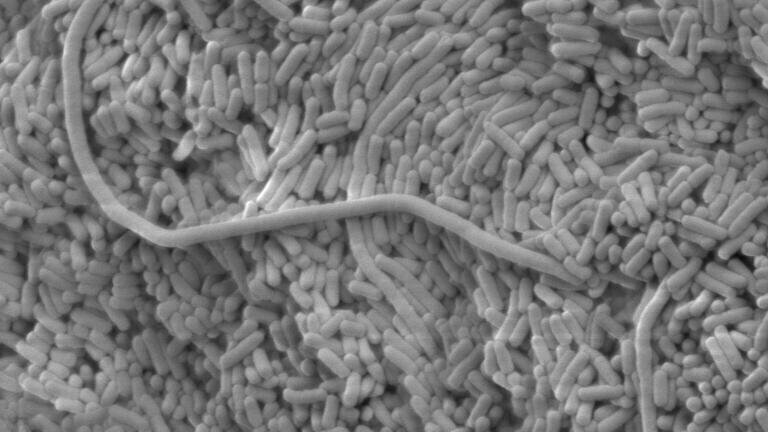 Microscope image of bacteria. (Credit: Biomedical Imaging Unit, UHS)