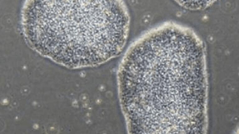 Colony of iPSCs grown using StemFit Basic04 CT.