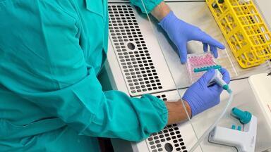 Streamlining immune sensing and signalling dynamics research with liquid handling tools