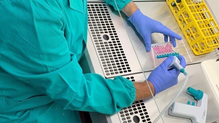 Streamlining immune sensing and signalling dynamics research with liquid handling tools