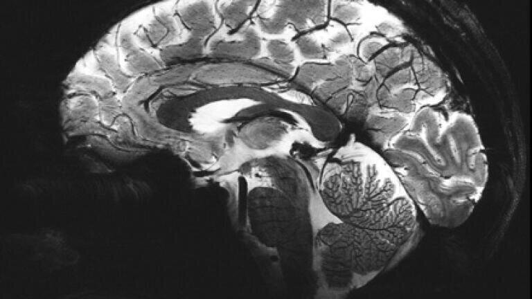 One of the first 11.7T images of the human brain recently acquired on a similar scanner at Neurospin in Paris. It has an in-plane resolution of just 200 microns. (Credit: University of Nottingham)