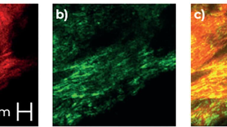 SHG images of collagen fibres. Images a) and b) are images of the same sample collected in the forward and backward directions respectively. Image c) is a composite showing the detail of the fibres.