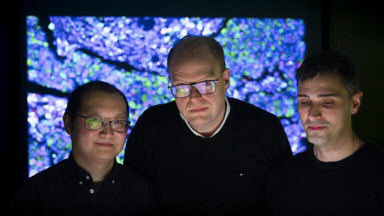 Dr Ke Yuan, Professor John Le Quesne and Dr Adalberto Claudio Quiros standing in front of a projection of one of the cancer sample slides used to train the machine learning algorithm used in the study.