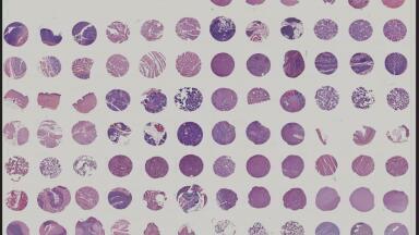 FDA-compliant tissue microarrays