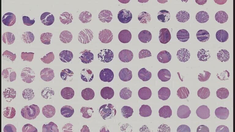 FDA-compliant tissue microarrays