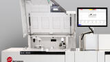 New integrated chemistry and immunoassay analyser