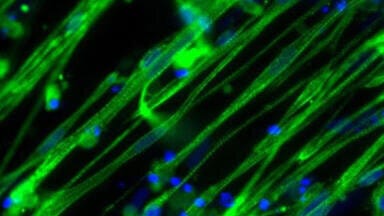 Sourcing, growing and differentiating human skeletal muscle cells