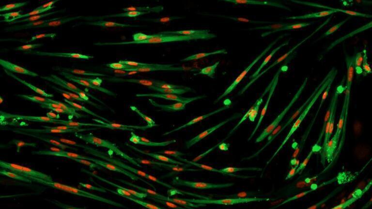 Skeletal muscle precursor cells (stage II and III) produced with the Skeletal Muscle Differentiation Kit. (courtesy: Douglas Smith - Doles Lab)