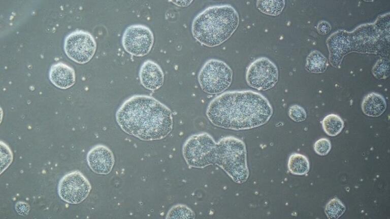 iPSC colonies.