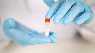 PCR Biosystems introduces advanced inhibitor-tolerant qPCR mixes for superior detection on challenging samples