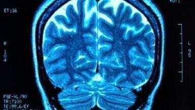 Could parasites be used as neurological treatment carriers?