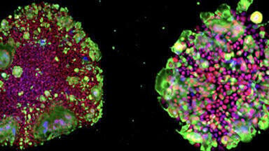 iPSC culture techniques for drug discovery and therapeutics