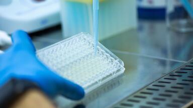 Precise detection of mycoplasma contamination in cell cultures