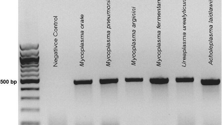Sample gel ran using the recommended cycling conditions.