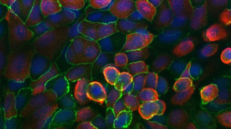 Changes triggered by SARS CoV 2 infection in lung on chip alveoli cells (Credit: Tanja Suligoj and Catherine Booth Quadram Institute)