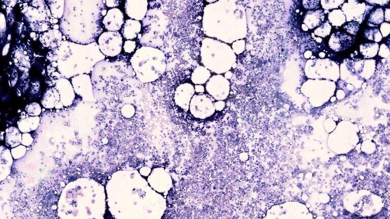 Expanded partnership launches first digital bone marrow imaging and analysis