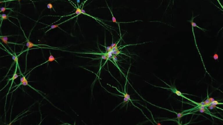 Iinduced Pluripotent Stem Cells Derived Neurons stained using CellO-IF technology. Courtesy of Didem Demirbas, PhD - Jenny Lai, MD-PhD Candidate, Boston Children's Hospital, Harvard Medical School