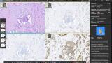 Digital pathology platform delivers comprehensive diagnostics