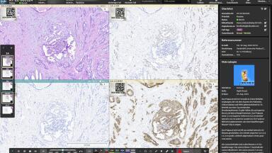 Digital pathology platform delivers comprehensive diagnostics