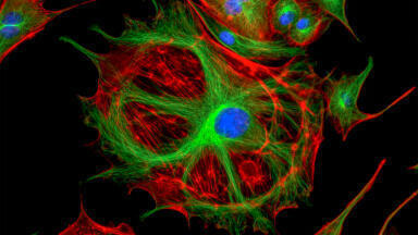 Direct translocation of proteins into living cells