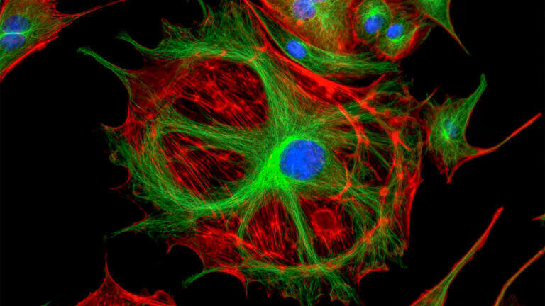 Direct translocation of proteins into living cells