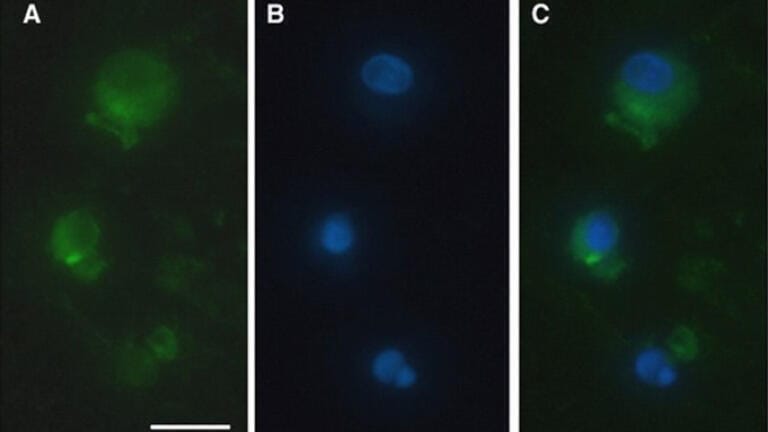 Primary rat monocytes were loaded with NGF using BioPorter®. NGF (FITC) and Nuclei (DAPI). Image from Böttger et al (2010).