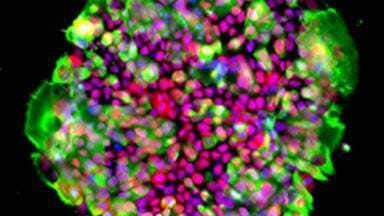 New laminin isoform kit simplifies cell culture workflow