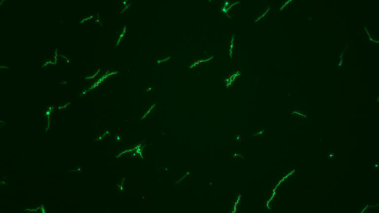 Borrelia burgdorferi sensu stricto expressing a green fluorescent protein