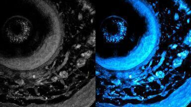 MIT non-invasive imaging method uses high-powered lasers to penetrate ever deeper into living tissue