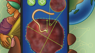 Smartphone app for assessing placentas set to improve neonatal and after-birth care