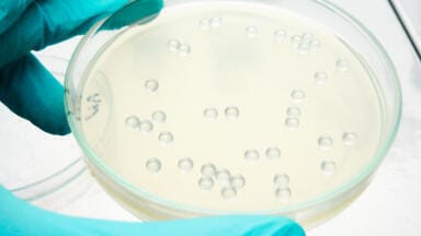 Optimised plating of bacterial and yeast cells on agar plates